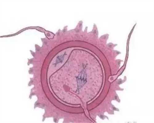 山东捐卵试管婴儿,卵巢囊肿可能致不孕 月经期同房也会中枪 