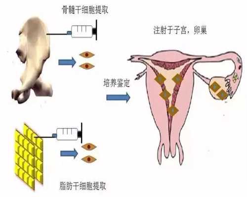 苏州合法捐卵，宫寒不孕去做广州供卵试管试管婴儿前要怎么调理？
