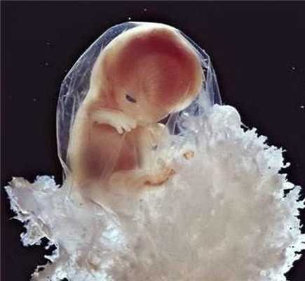 哈尔滨女生捐卵,捐卵卵子和精子结合竟是看精子长的帅不帅！_1